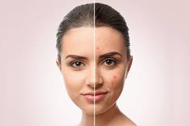 Clinical Dermatology