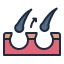 Pattern Hair Loss